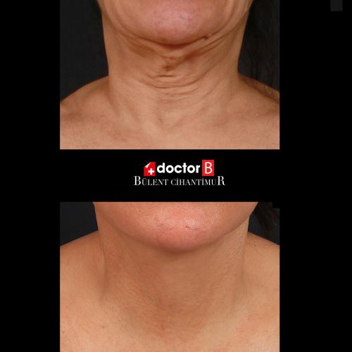 Before after photos of our patients 2